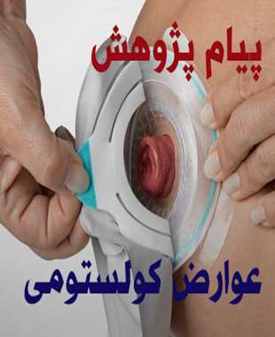 شایعترین عوارض ایلئوستومی و کولستومی